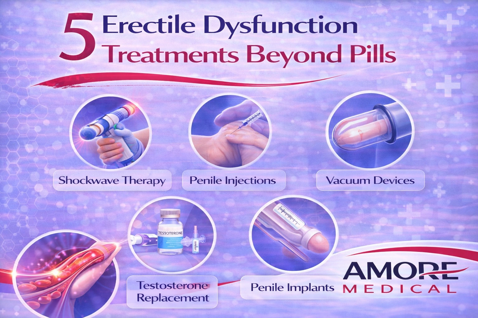 5 Erectile Dysfunction Treatments Beyond Pills